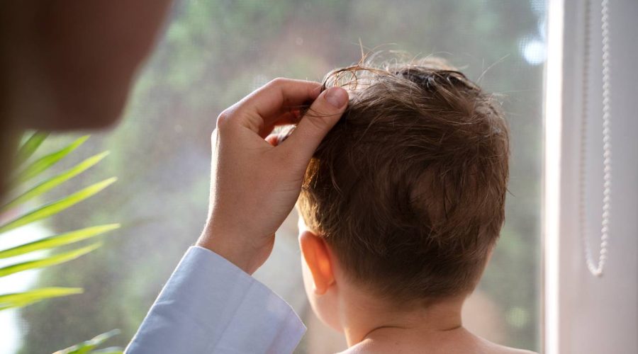 Caída de pelo en niños: ¿por qué se produce y cuándo preocuparse?