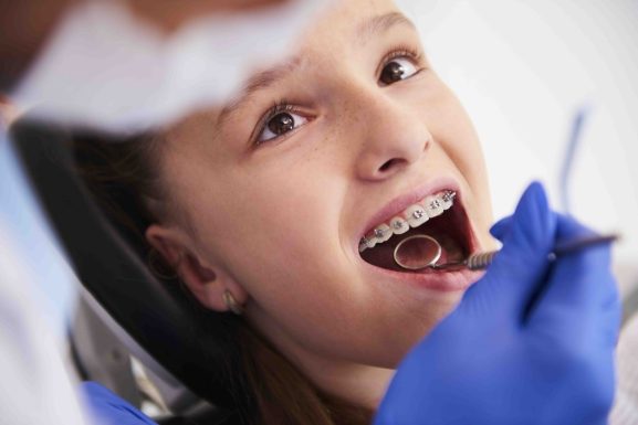 Ortodoncia: diferentes tratamientos para los niños